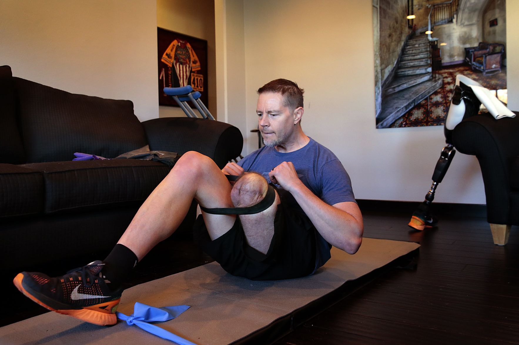 Champion cyclist chooses amputation following skateboarding accident